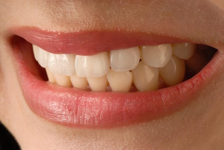 asian-smile-3672997_1280